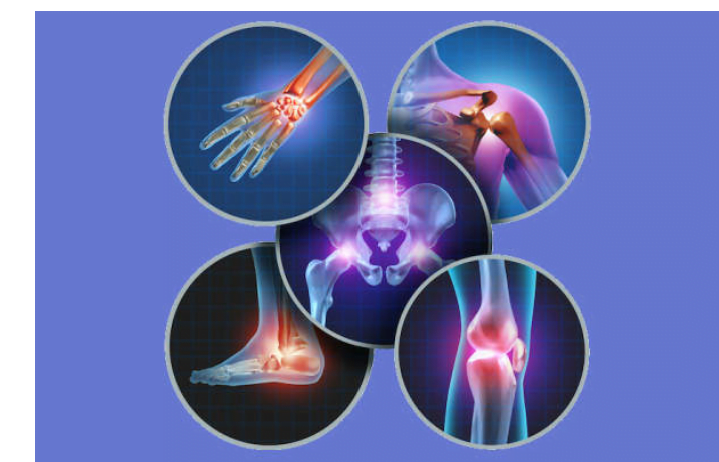 روماتیسم مفصلی