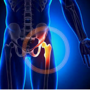 درد کشاله ران